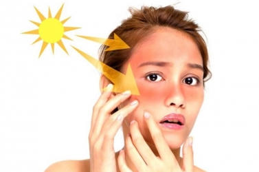 Vì sao da dễ xỉn màu sau mùa hè? Bí quyết làm đẹp da cho phái đẹp